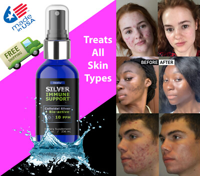 #ad TOP RATED MOISTURIZERS PREVENT HEAL PIMPLE ACNE Rash Antibacterial Cure USA $34.45